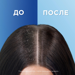 Шампунь для жирных волос HEAD&SHOULDERS Цитрусовая свежесть, 400мл